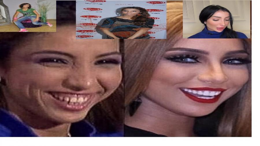 دنيا باطما : من عمليات التجميل إلى التباهي بالمؤخرة ومفاتن الجسد